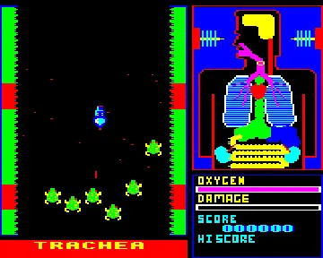 Frankenstein 2000 (1985)(Icon Software)[a] screen shot game playing